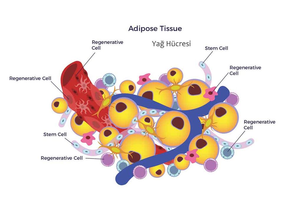 Lipo İnflamasyon Nedir?
