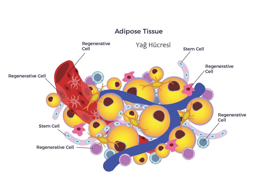 Lipo İnflamasyon Nedir?